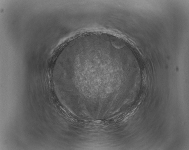 X0000065241494200603031725