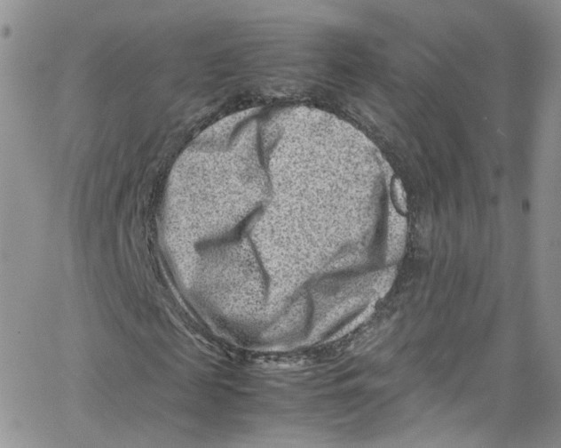 X0000065250817200603131125