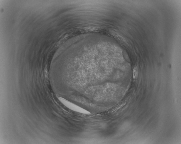 X0000065251011200603131122