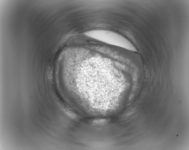 X0000065250357200603172210