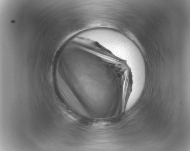 X0000065250387200603172210