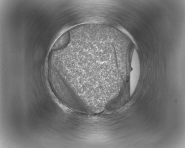 X0000065251099200603172158