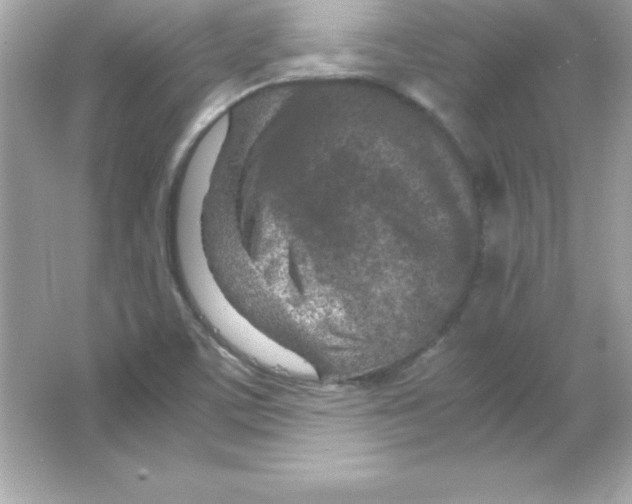 X0000065251459200603172151