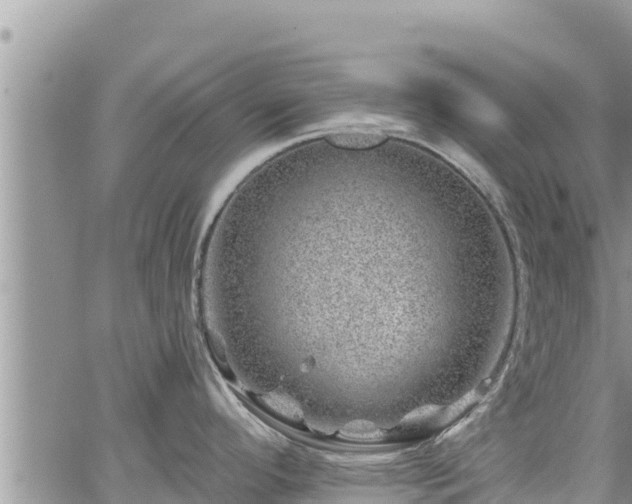 X0000065261296200602211240