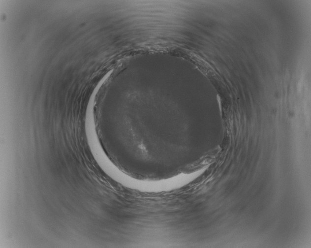 X0000065261010200603131157