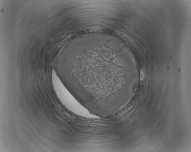 X0000065261011200603131157