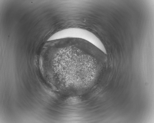 X0000065260280200603172238