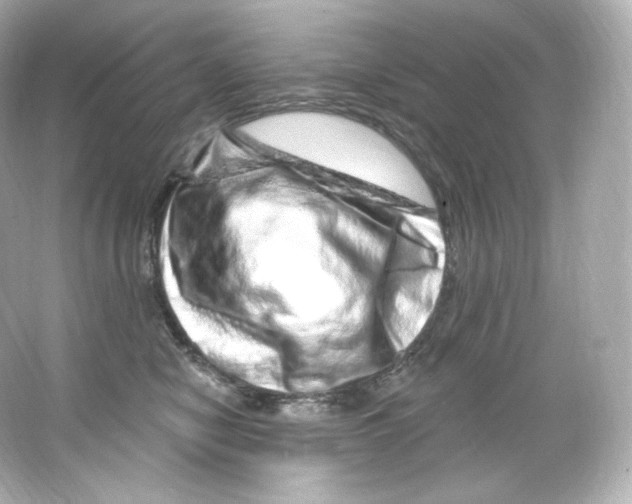 X0000065260470200603172235