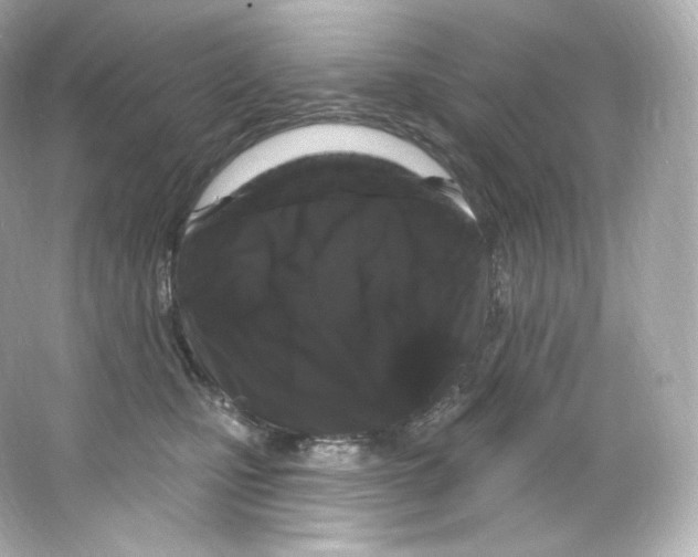 X0000065260471200603172235