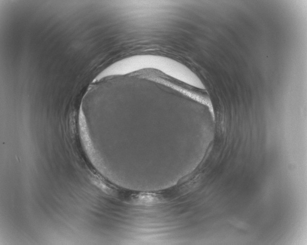 X0000065260475200603172235