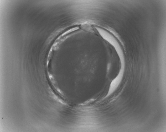 X0000065260577200603172233