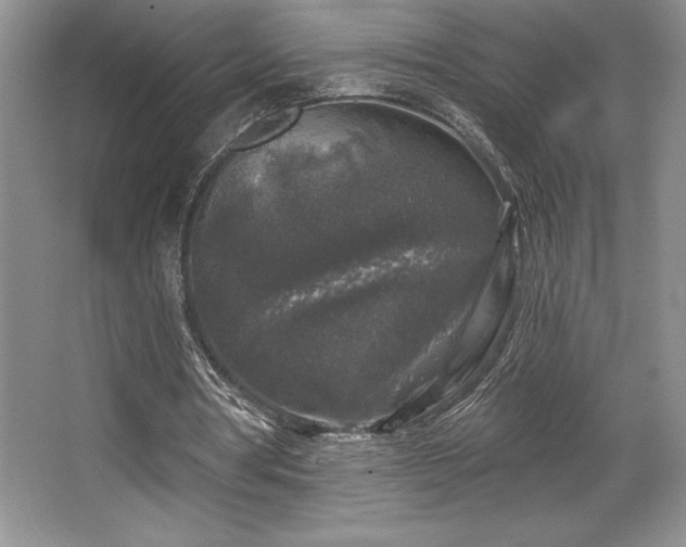 X0000065950386200603061130