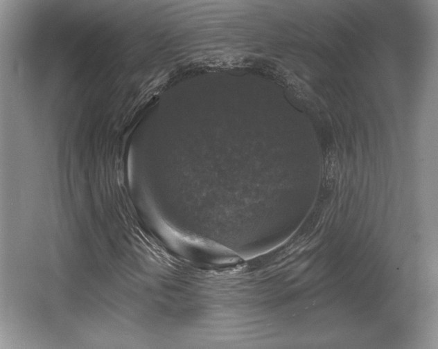 X0000065951202200603061115