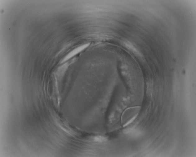 X0000065950165200603172008