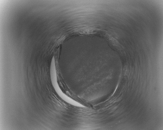 X0000065951202200603311737