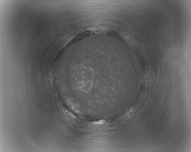 X0000065961010200603061145