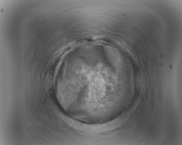 X0000065960043200603172035