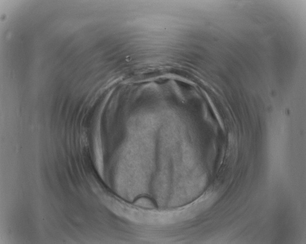 X0000065960048200603172035