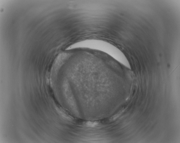 X0000065960570200603172027