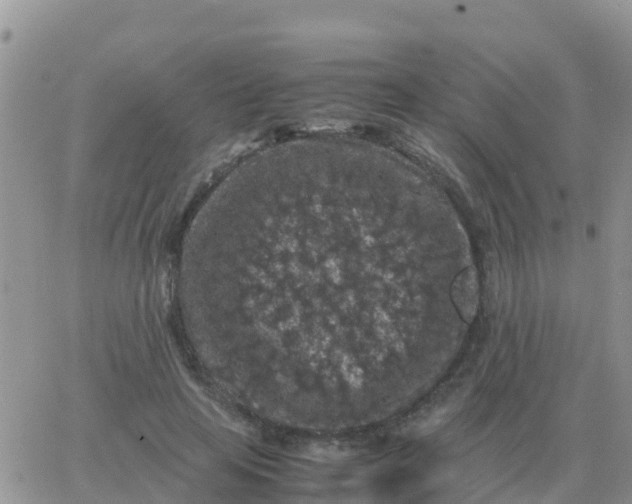 X0000065960641200603172025