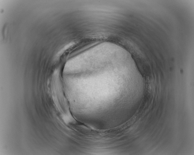 X0000065960692200603172025