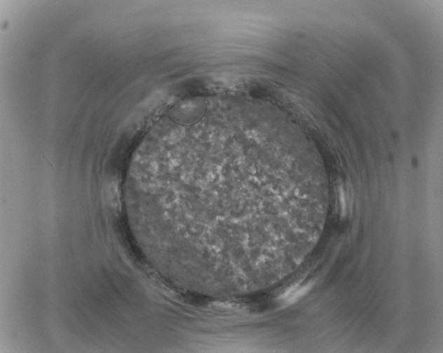 X0000065960699200603172025