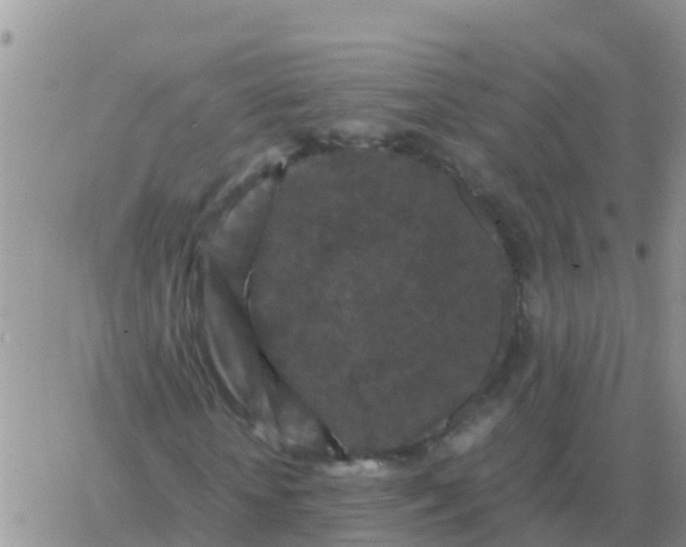 X0000065960818200603172022