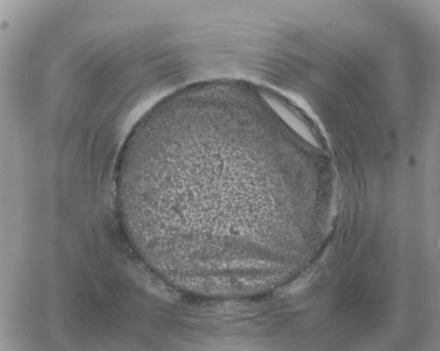 X0000065960879200603172022