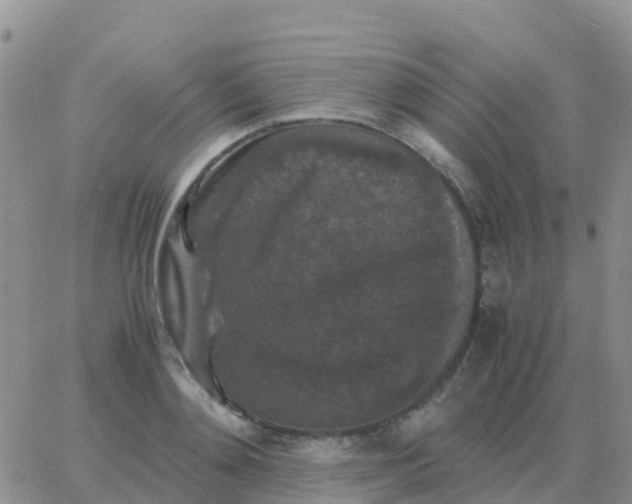 X0000065960892200603172022