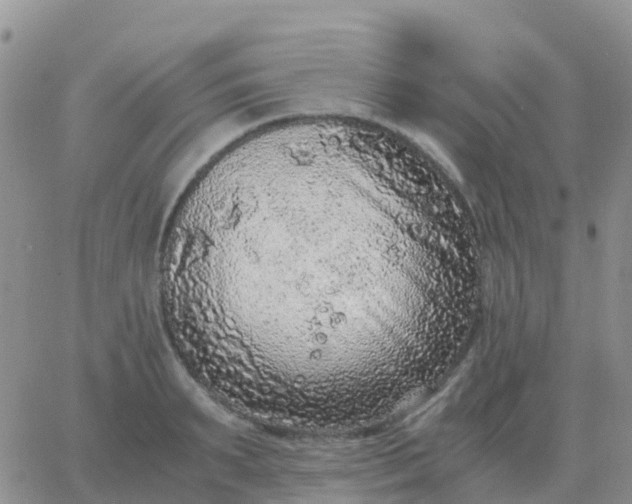 X0000065960895200603172021