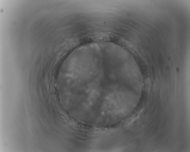 X0000065960913200603172020