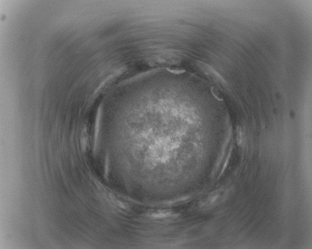 X0000065960915200603172020