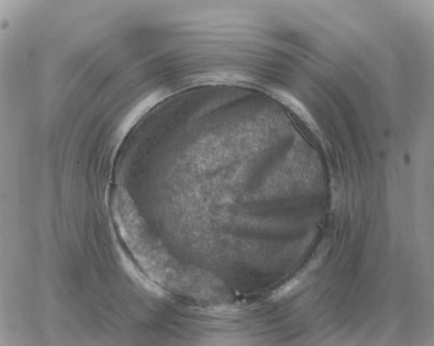 X0000065960946200603172021