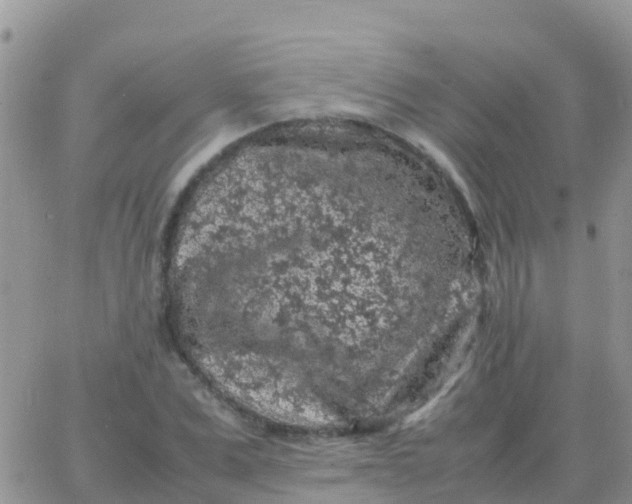 X0000065960975200603172020