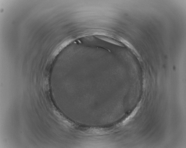 X0000065960977200603172020