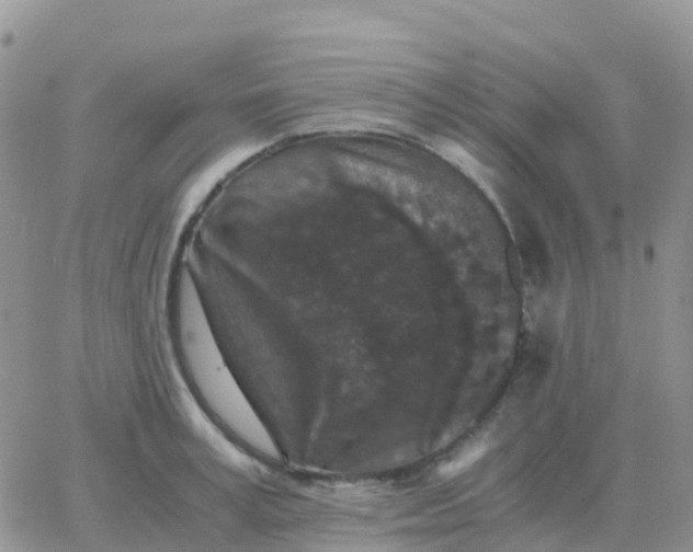 X0000065960995200603172020