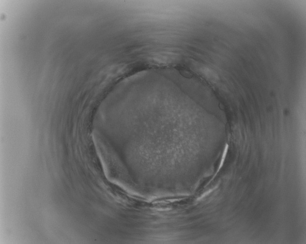 X0000065961009200603172019