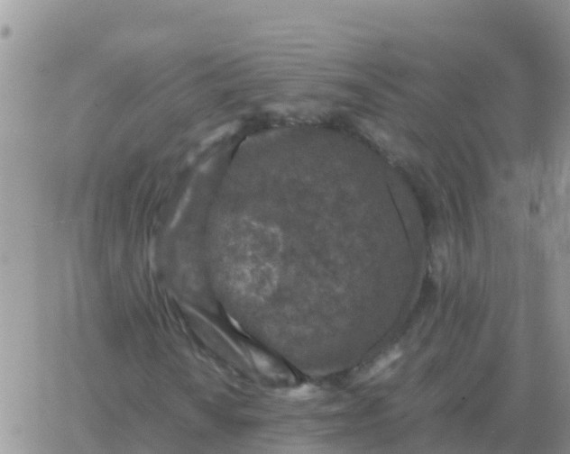 X0000065961010200603172019