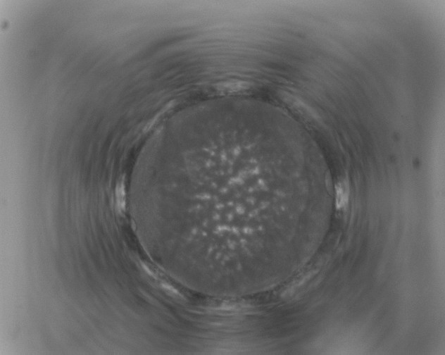 X0000065961011200603172019