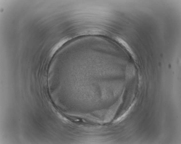 X0000065961081200603172018