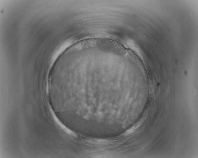 X0000065961095200603172018