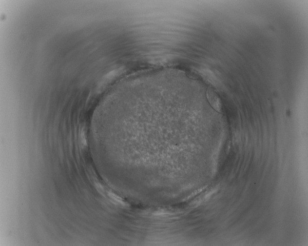 X0000065961106200603172017