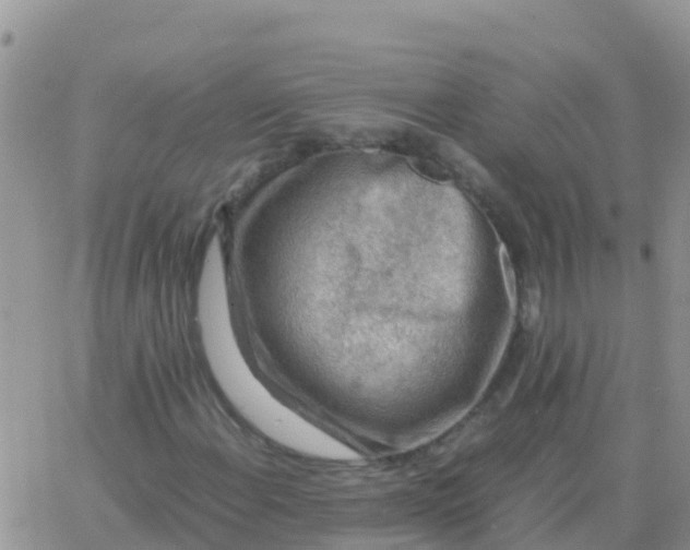 X0000065961108200603172017