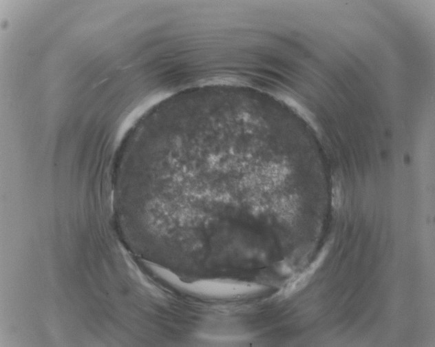 X0000065961117200603172017