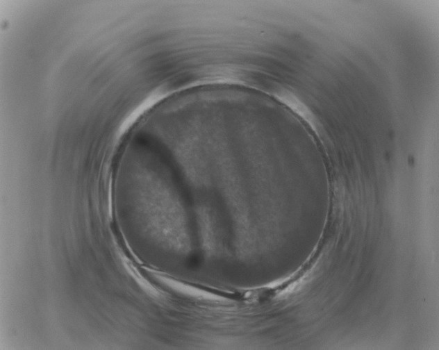 X0000065961127200603172018