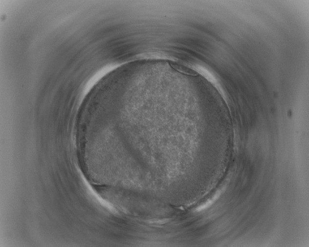 X0000065961141200603172018