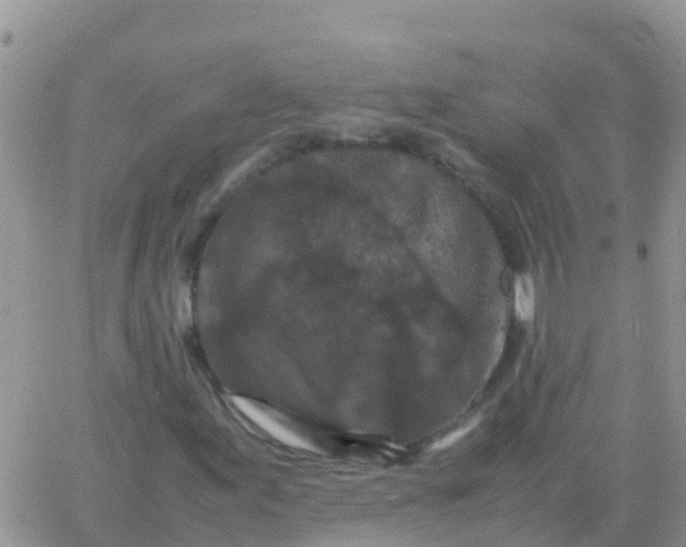 X0000065961155200603172017