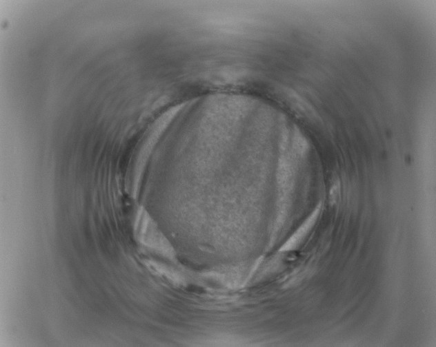 X0000065961156200603172017