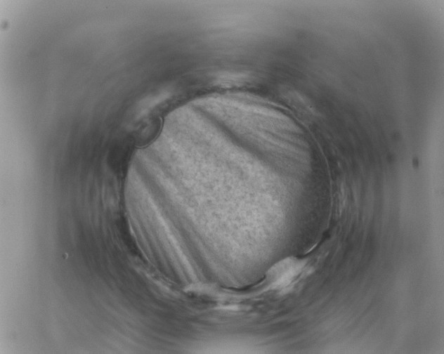 X0000065961158200603172017