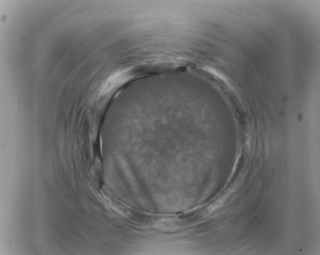 X0000065961161200603172017